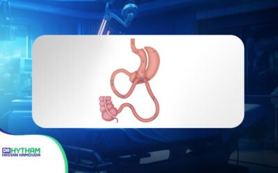 كيف تقلل عملية الساسي امتصاص السعرات وتساعد على فقدان الوزن؟