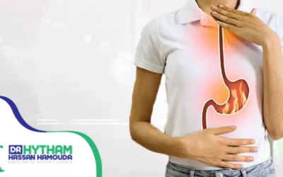 علاج الارتجاع المريئي