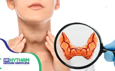 علاج تضخم الغدة الدرقية بدون جراحة