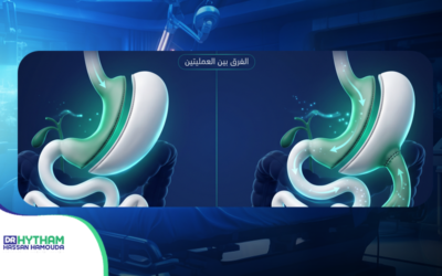 هل تعرف حقًا الفرق بين الساسي والتكميم؟