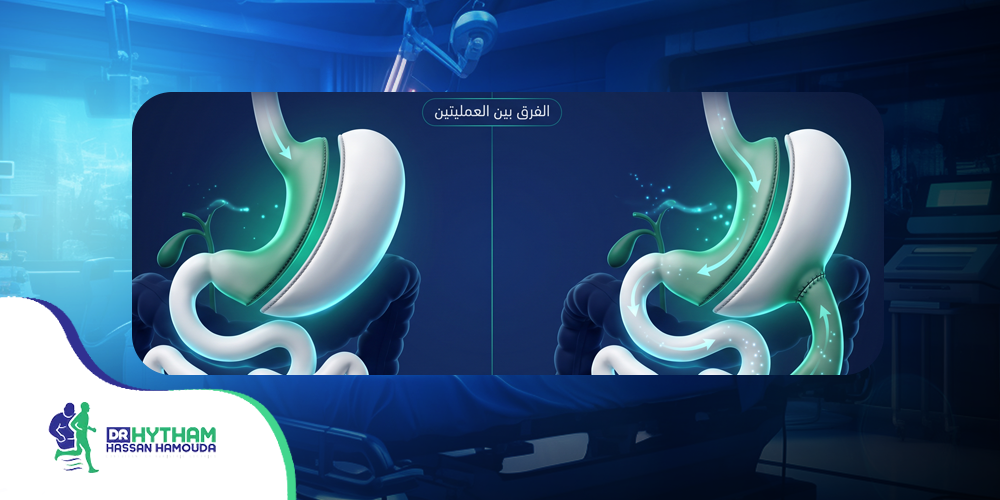 الفرق بين الساسي والتكميم